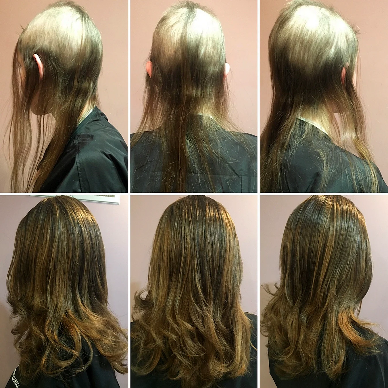 Отращивание волос до и после