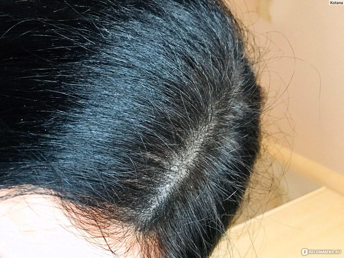 Отросшие волосы после окрашивания в черный