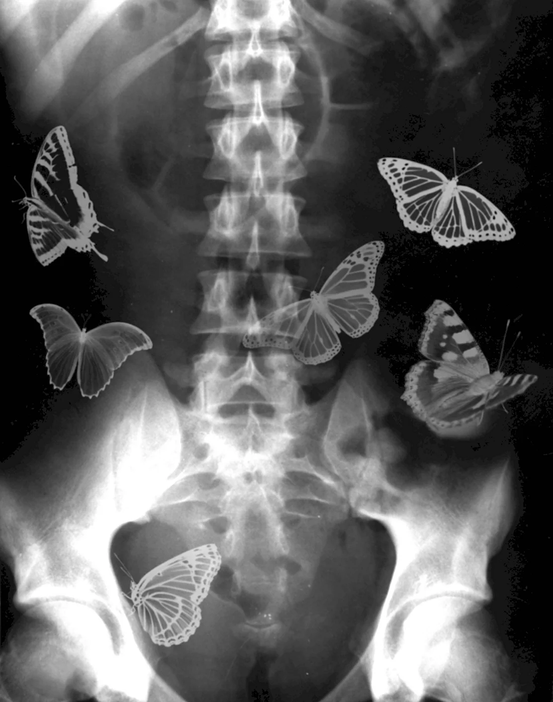 Бабочки в животе