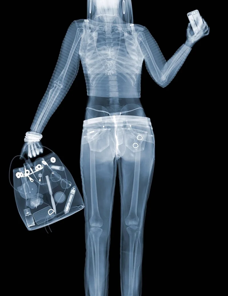 Ким Кардяшан с рентгеном