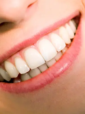 Красивые зубы