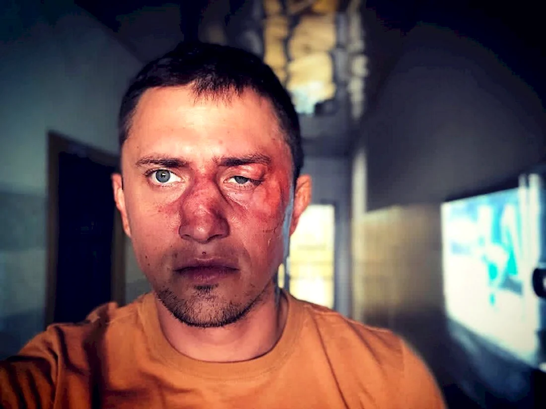 Павел Прилучный после драки