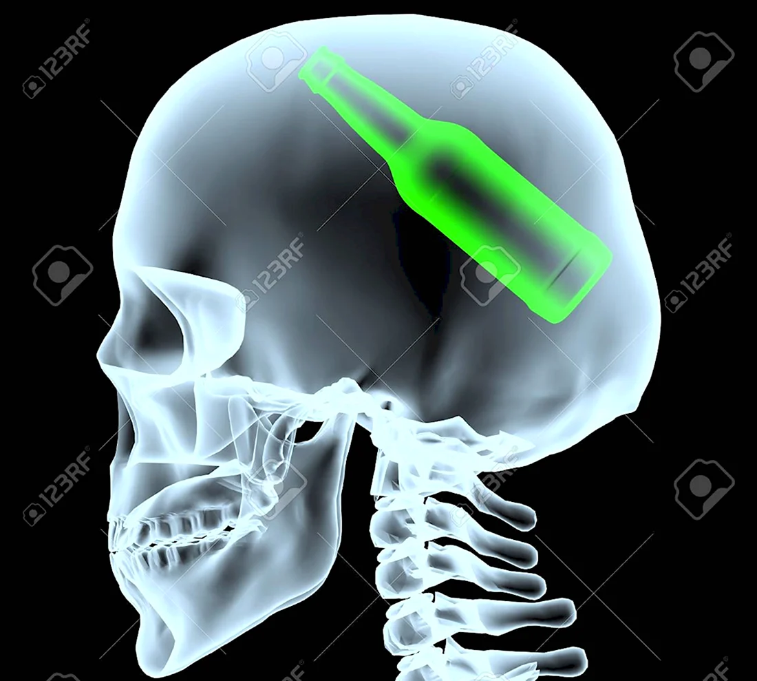 Рентген снимок скелета с мозгом