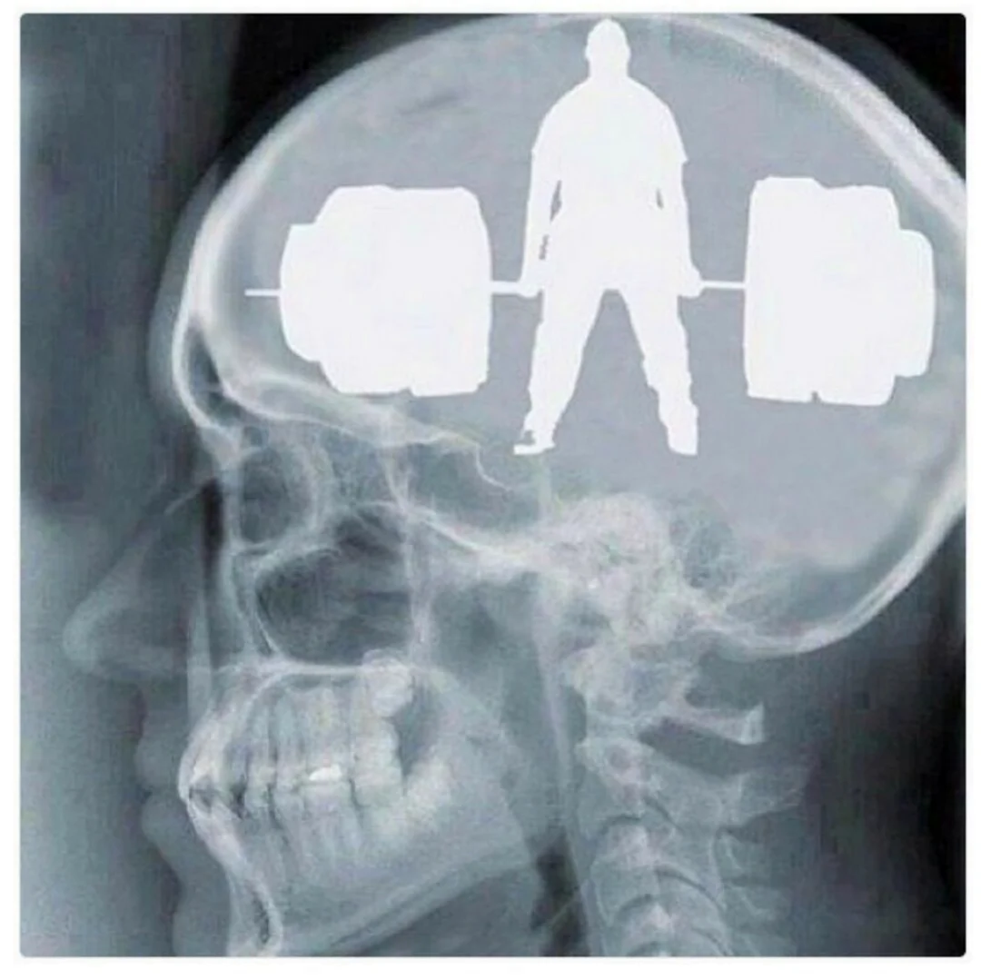 Рентгеновский снимок головы МОПСА