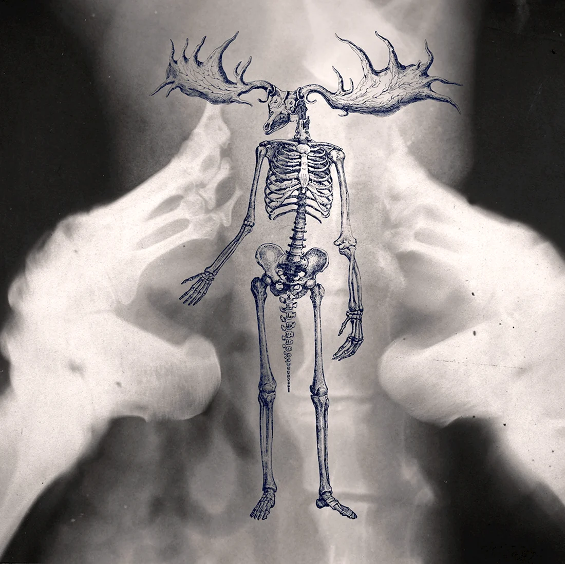 Рентгеновский снимок скелета