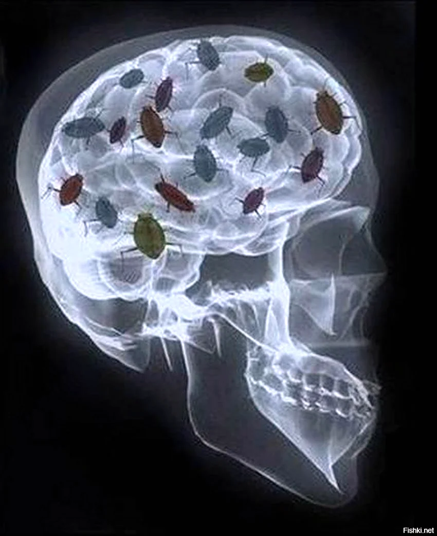 Тараканы в голове рентген