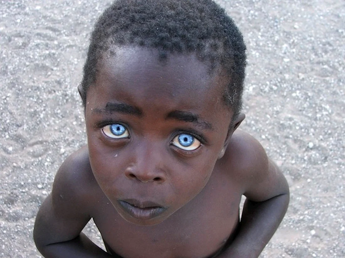 Темнокожий мальчик с голубыми глазами