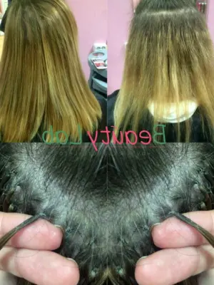 Волосы после снятия нарощенных волос