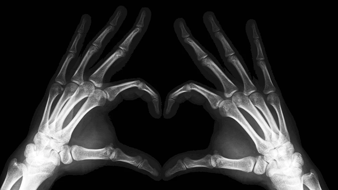 X-ray рентген