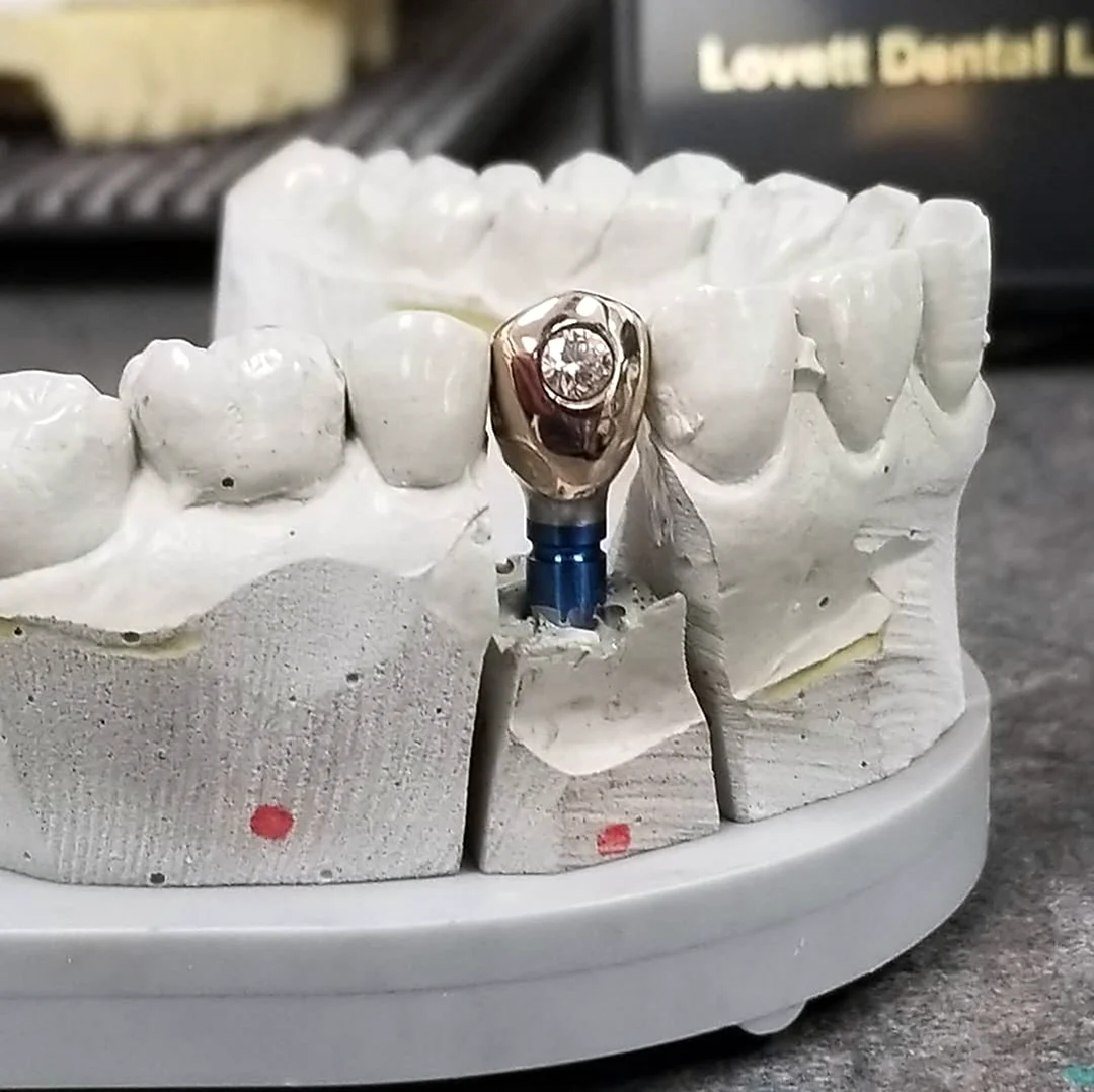 Зубные техники